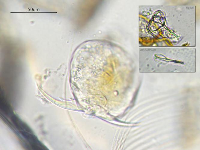 Cephalodella forficula, Grisolles 31, avirl 2020 © Anaëlle Bernard
